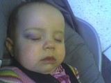 Mary asleep in her car seat. You can see a nice purple bruise over her right eye.