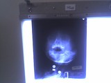 Mary's x-ray. It looks normal and you can see daddy's hand under her chin.